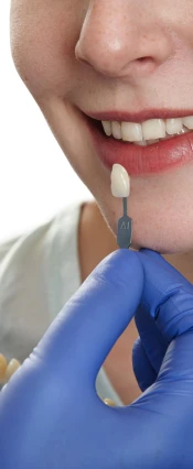 Mono Implant